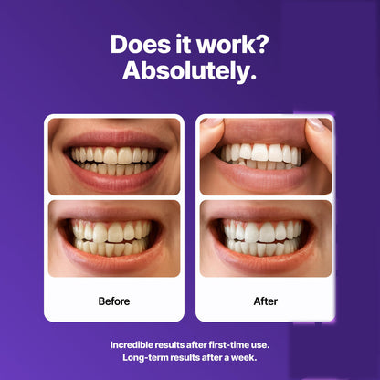 VioletSmile Strips